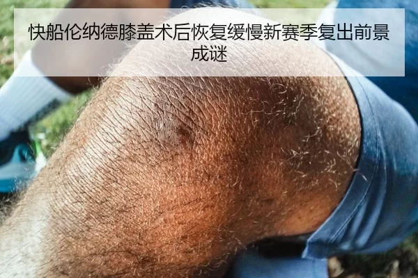 快船伦纳德膝盖术后恢复缓慢新赛季复出前景成谜